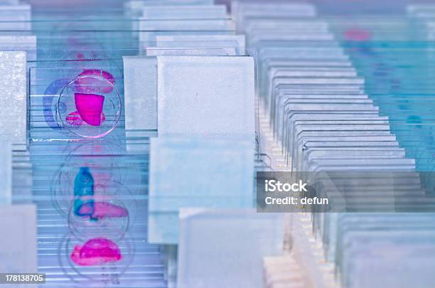 Ciencia Portaobjetos De Microscopio Foto de stock y más banco de imágenes de Portaobjetos de microscopio - Portaobjetos de microscopio, Enfermedad, Histología