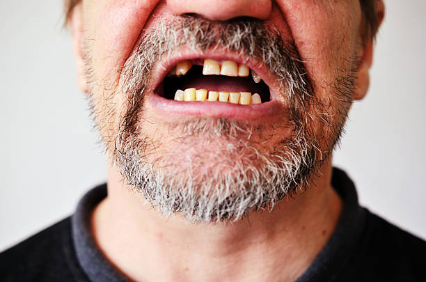Uomo faccia con la bocca aperta senza denti - foto stock