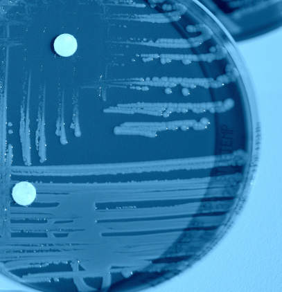 Bacterium grown an agar plate with disks of antibiotics.