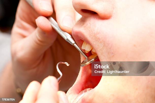 U Dentysty - zdjęcia stockowe i więcej obrazów Badanie lekarskie - Badanie lekarskie, Biuro, Bliskie zbliżenie