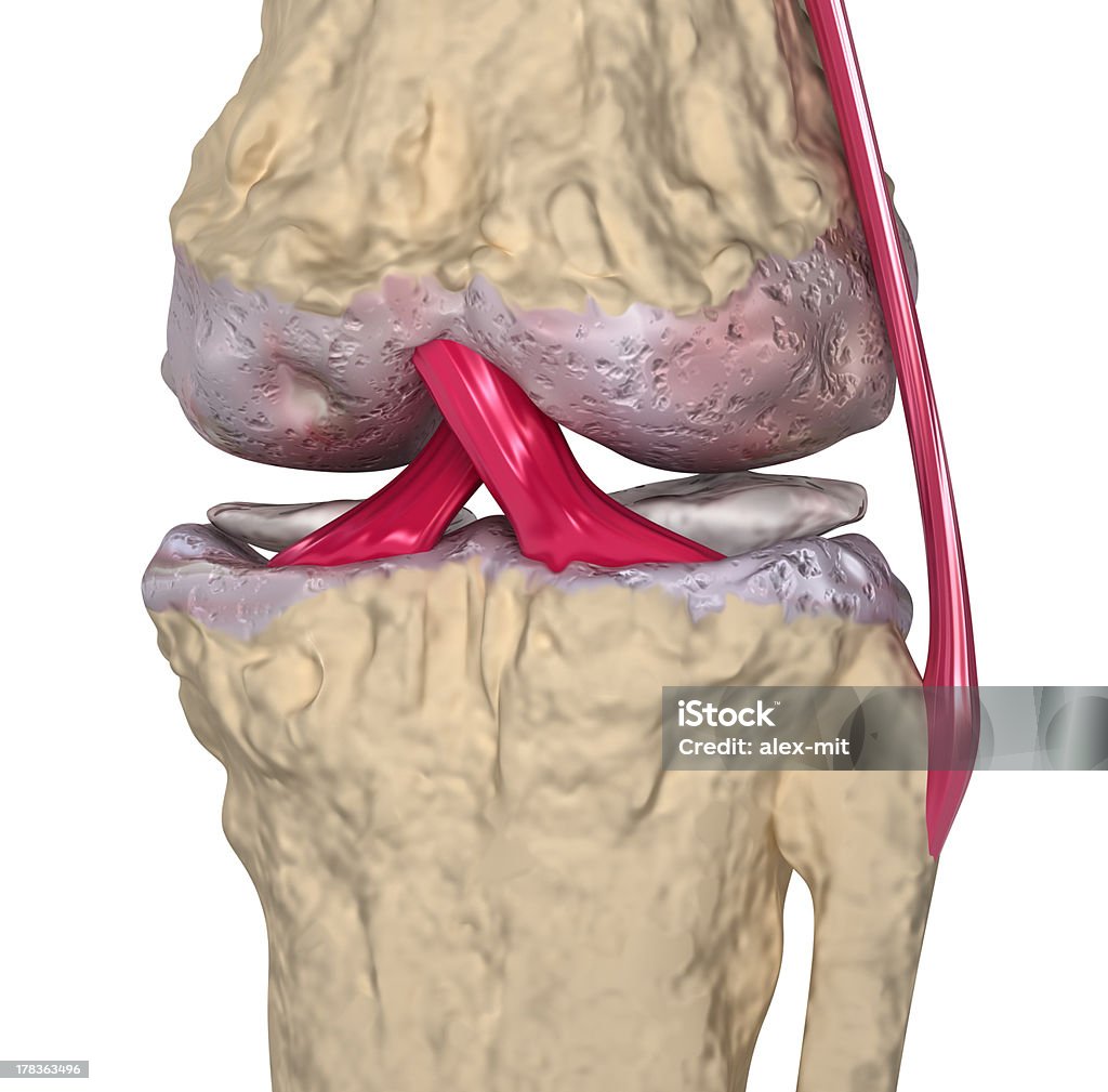 Choroba zwyrodnieniowa stawów: Stawu kolanowego z więzadeł i cartilages - Zbiór zdjęć royalty-free (Anatomia człowieka)