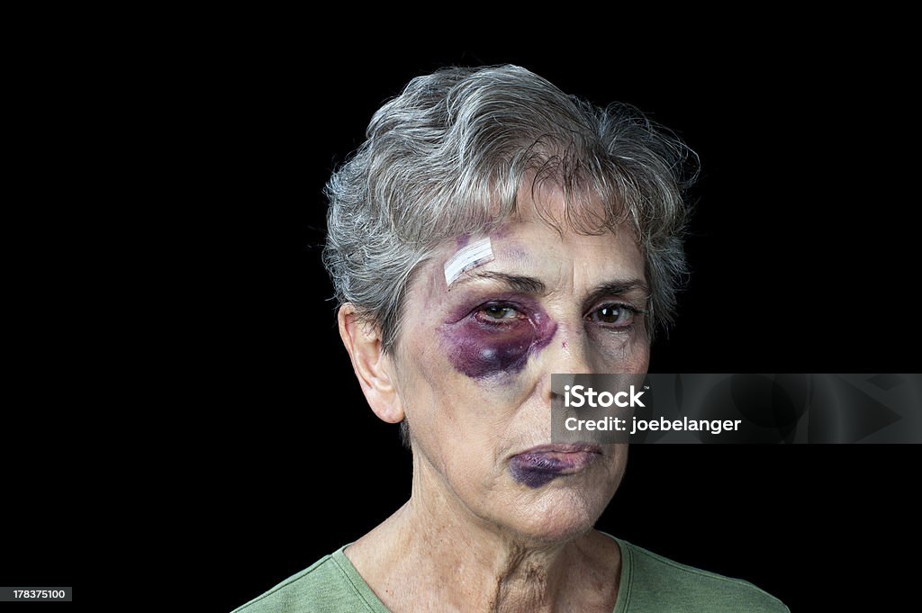 Beaten old woman "An elderly grandmother badly beaten with stitches, a black eye and a fat lip." Black Eye Stock Photo