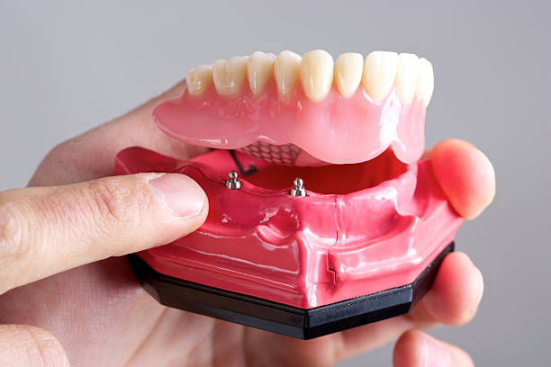 mit audiosystem - dentures stock-fotos und bilder