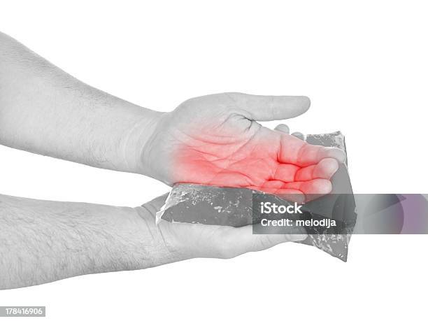 Tonos Paquete De Gel En Una Inflamación Herir Palm Foto de stock y más banco de imágenes de Adulto