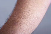Goosebumps on hairy man's arm