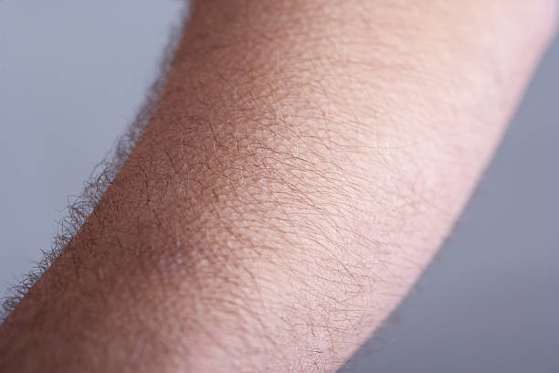 Goosebumps on hairy man's arm stock photo