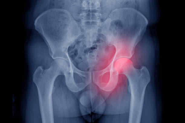 istock Film x-ray human's pelvis 1784401725