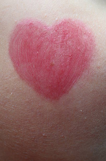 istock Pink heart shape on cheek's skin 178470927