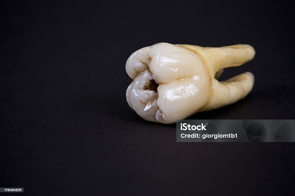 Artificiel de dents en céramique - Photo de Tirer libre de droits