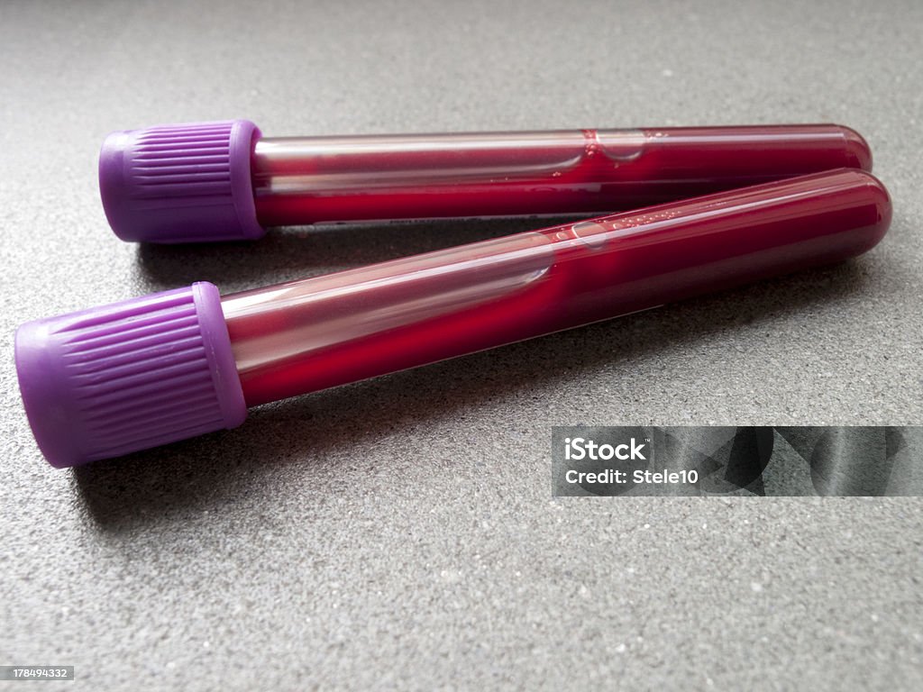 Test sanguin Vials - Photo de Tube à essai libre de droits