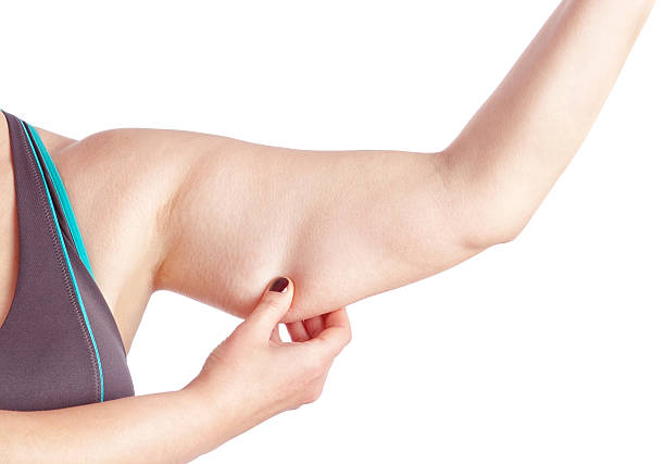 istock Middle-aged woman holding a hand with excess fat. 178499778