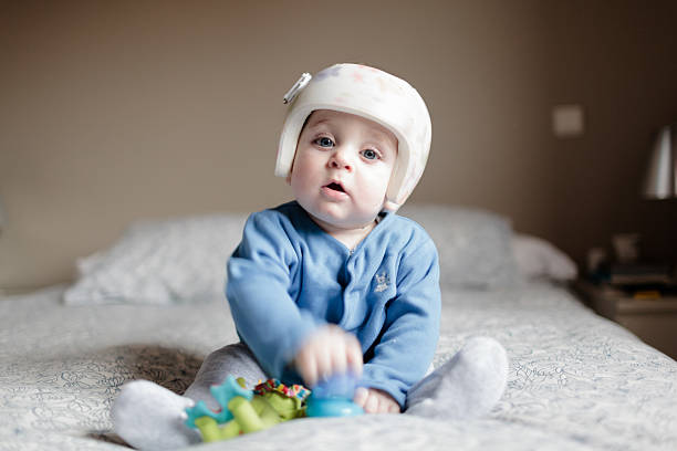 baby with helment for  Plagiocephaly cute baby boy 6 months old looking at camera. He is wearing a helmet to correct plagiocephaly and he is playing with a green toy while wearing a blue jaket plagiocephaly stock pictures, royalty-free photos & images