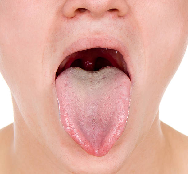istock guy shows his throat, tongue 178506758