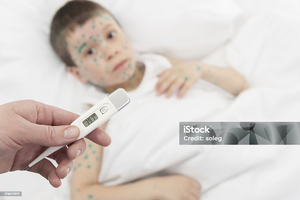 Misurazione della temperatura ragazzo malato a letto - Foto stock royalty-free di Acne