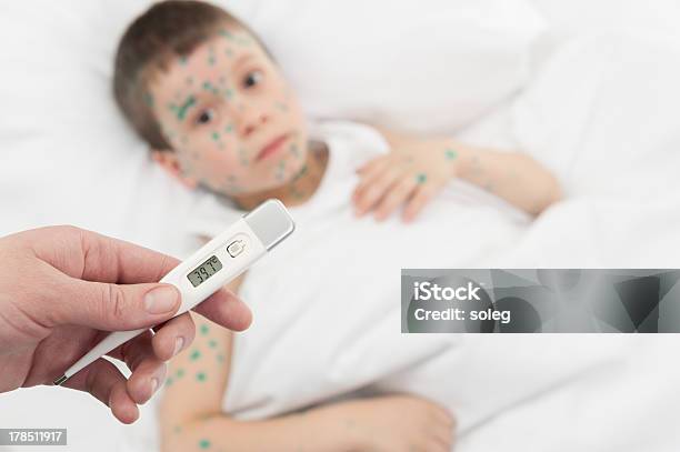 Medição De Temperatura Menino Na Cama Doente - Fotografias de stock e mais imagens de Acne - Acne, Branco, Cama