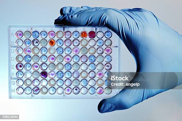 Ręka Z Test Mikropłytkowy - zdjęcia stockowe i więcej obrazów Badanie lekarskie - Badanie lekarskie, Budowa molekularna, Analiza laboratoryjna