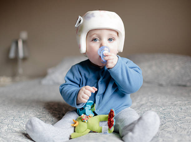 Bebé con helment para Plagiocephaly - foto de stock