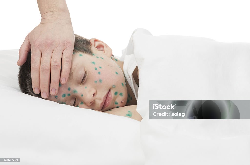 Niño enfermo en cama blanca - Foto de stock de Acné libre de derechos