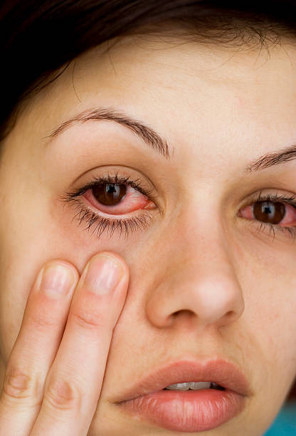 Sick woman pulling down her eyelid to see red eyes http://i1364.photobucket.com/albums/r725/hofi99/UJBANNER2/andrea_banner_zps2cf1a621.jpg vascular bundle stock pictures, royalty-free photos & images