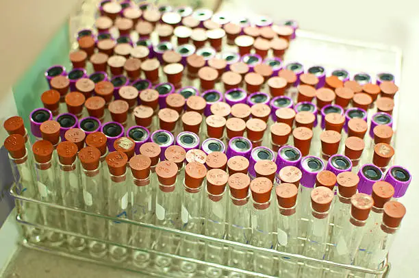 Photo of many test tubes
