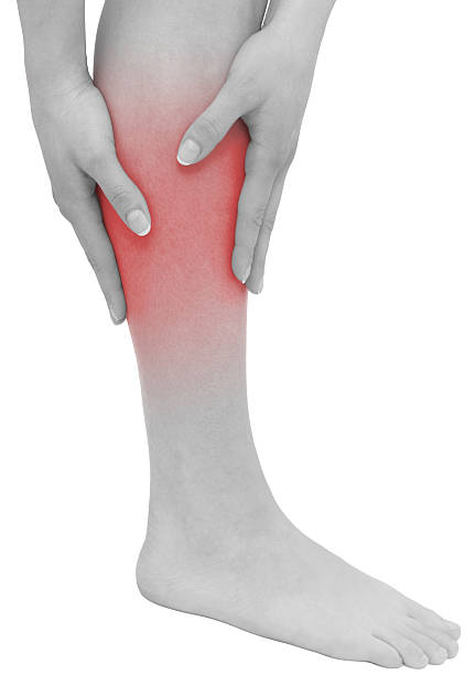 istock Acute pain in a woman calf 178584573