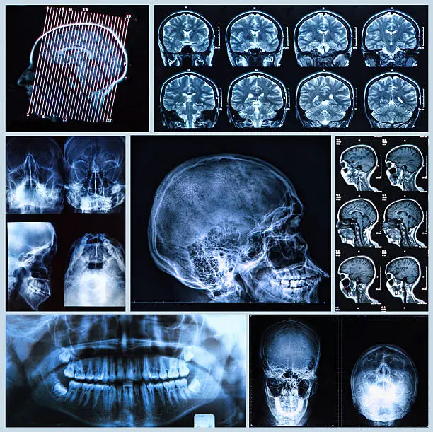 Photo of Head and neck anatomy