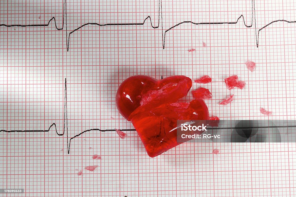 ЭКГ cardiogram с разбитого сердца. - Стоковые фото Анализировать роялти-фри