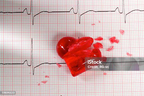 Экг Cardiogram С Разбитого Сердца — стоковые фотографии и другие картинки Анализировать - Анализировать, Без людей, Внутренний орган человека