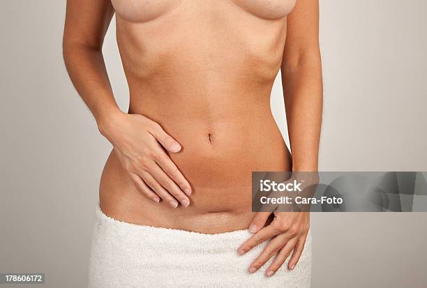 Photo libre de droit de Frau Mit Hände Bauch Narben banque d'images et plus d'images libres de droit de Abdomen - Abdomen, Adulte, Anatomie