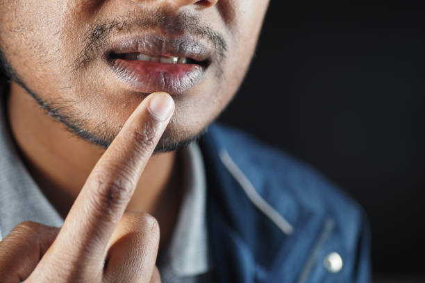 istock Close up of a young men hand dry lips 1786254056