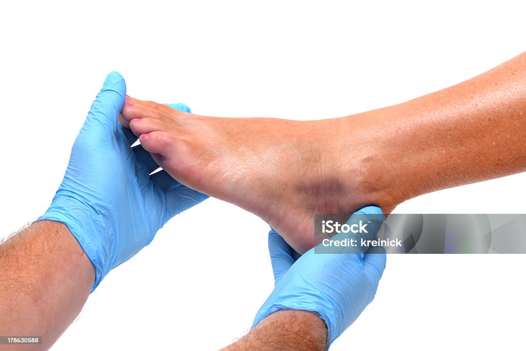 Ankle Bruise doctor examining an injured foot Doctor Stock Photo