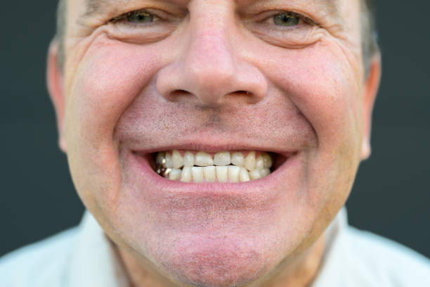 istock Extreme close up of a man's smile without his prosthesis 1787083629