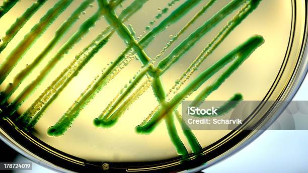 Aeroginosa Вызванная Псевдомонадами — стоковые фотографии и другие картинки Агар - Агар, Бактерия, Без людей