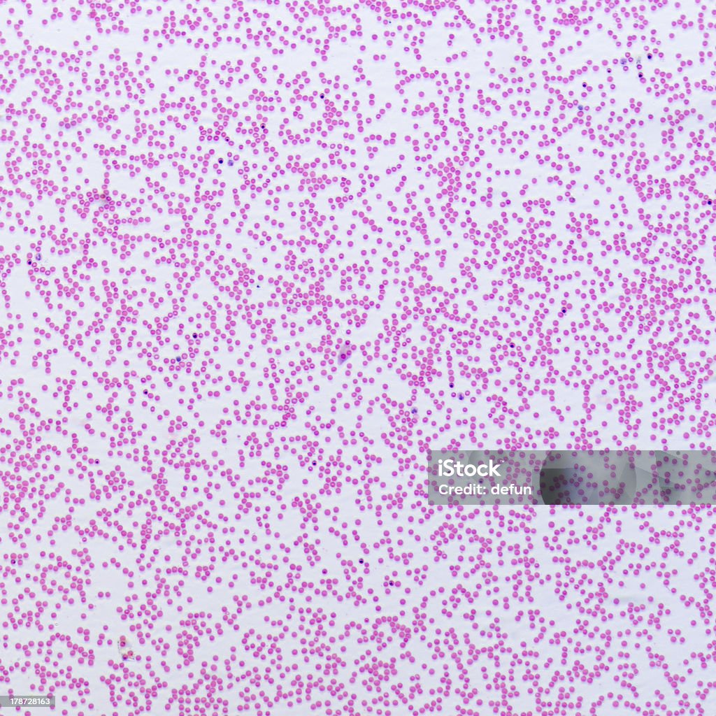 Клетки крови человека - Стоковые фото Анализ крови роялти-фри