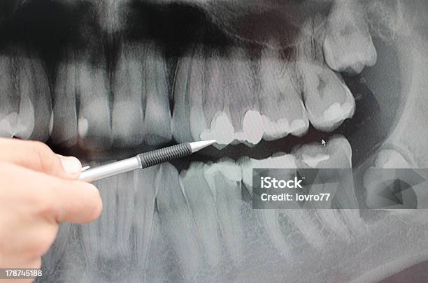 Dentale - Fotografie stock e altre immagini di Ambulatorio dentistico - Ambulatorio dentistico, Analizzare, Apparecchiatura odontoiatrica