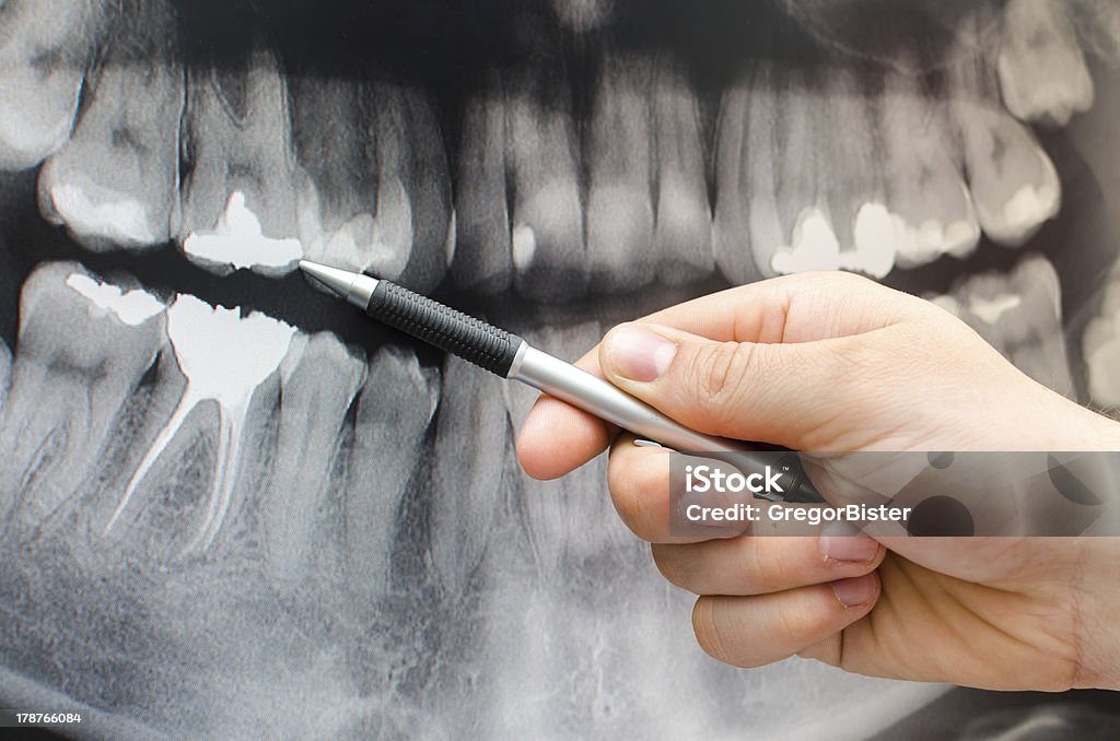 Dentaire dentiste montrant quelque chose sur x-ray image - Photo de Analyser libre de droits