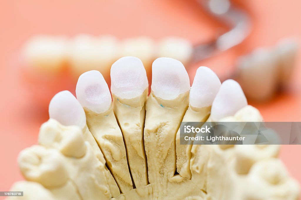 Zircon dentes - Foto de stock de Cerâmica - Artesanato royalty-free