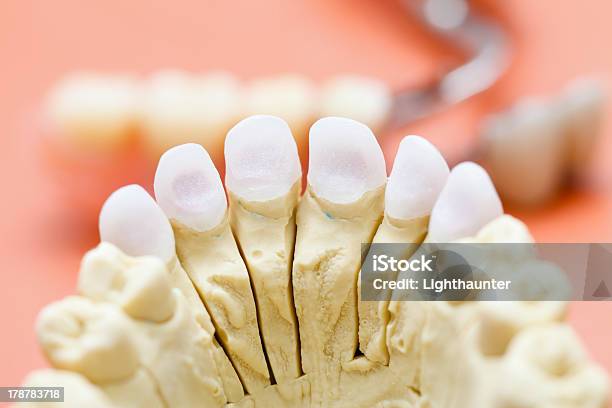 Foto de Zircon Dentes e mais fotos de stock de Cerâmica - Artesanato - Cerâmica - Artesanato, Consultório Dentário, Coroa dentária