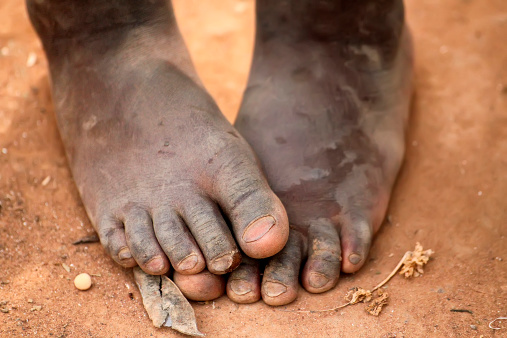 African boy feet