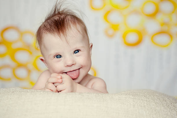 cheerful little baby girl with downs syndrome - mensentong stockfoto's en -beelden