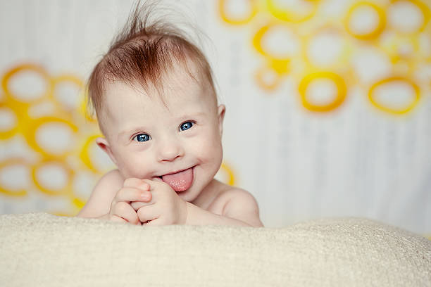 cheerful little baby girl with Downs Syndrome cheerful little baby girl with Downs Syndrome human tongue stock pictures, royalty-free photos & images