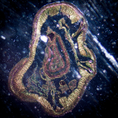 science microscopy micrograph earthworm crosscutting