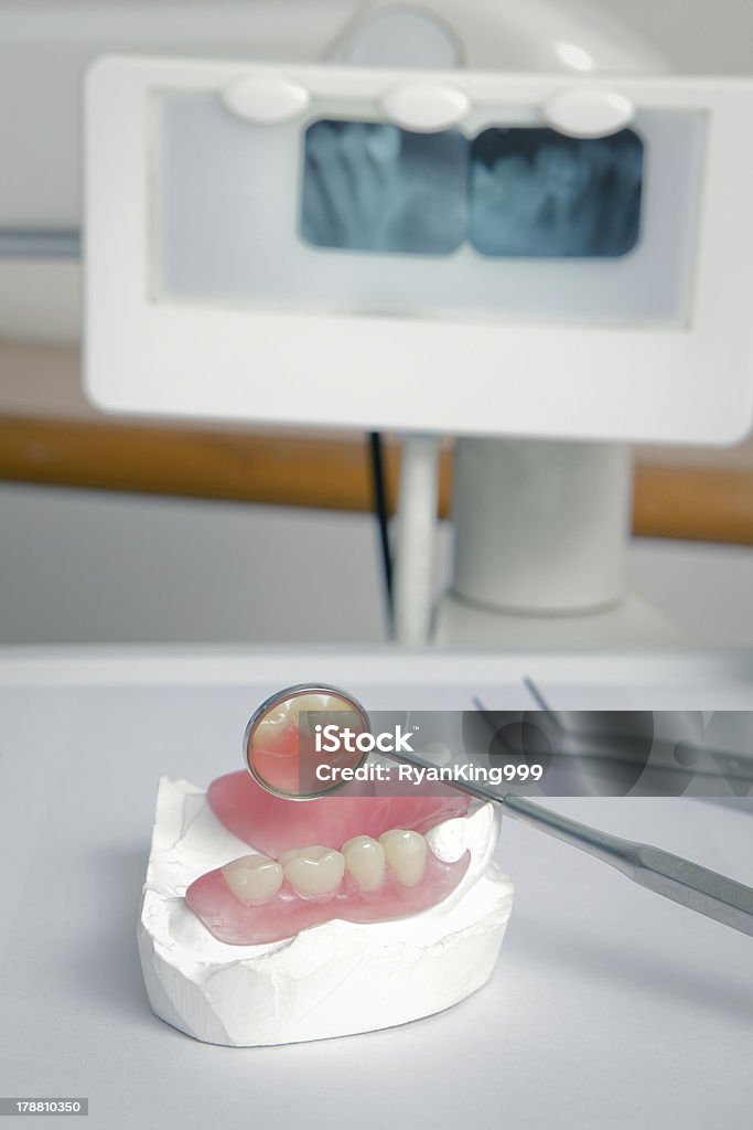 Dentysta narzędzia z akrylu protezy (sztuczne zęby) - Zbiór zdjęć royalty-free (Badanie lekarskie)