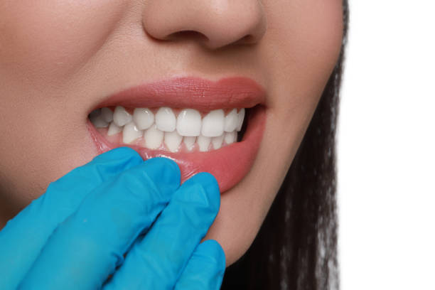 istock Doctor examining woman's gums on white background, closeup 1788161142