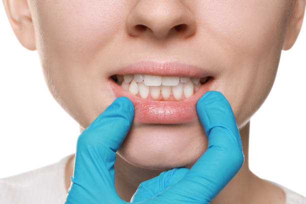 istock Doctor examining woman's gums on white background, closeup 1788161169