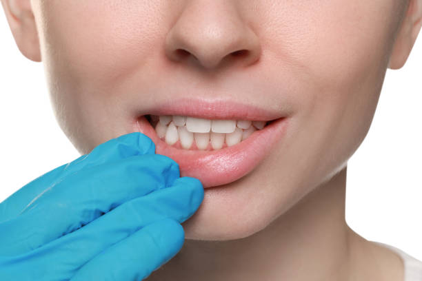 istock Doctor examining woman's gums on white background, closeup 1788161696