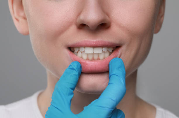 istock Doctor examining woman's gums on grey background, closeup 1788161711