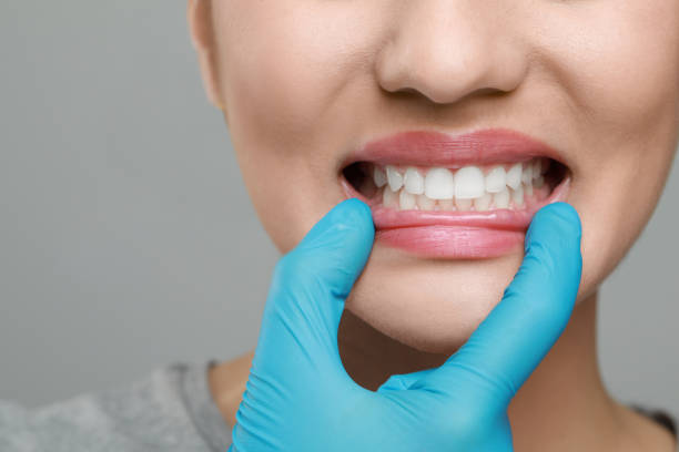 istock Doctor examining woman's gums on grey background, closeup 1788161819