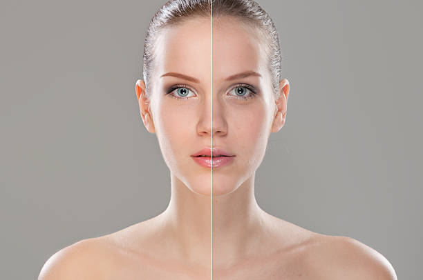 istock A woman before and after retouching 178828241