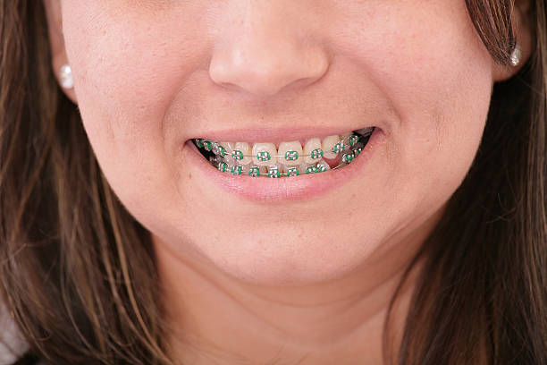 istock smiling young teenager with braces 178844676